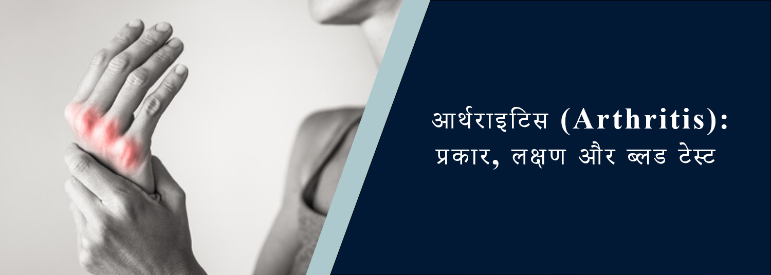 आर्थराइटिस (Arthritis): प्रकार, लक्षण और ब्लड टेस्ट