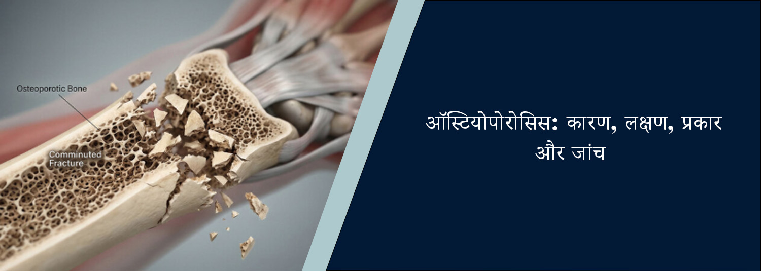 ऑस्टियोपोरोसिस: कारण, लक्षण, प्रकार और जांच