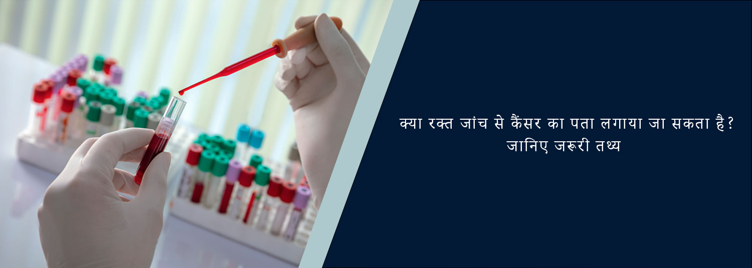क्या रक्त जांच से कैंसर का पता लगाया जा सकता है? जानिए जरूरी तथ्य
