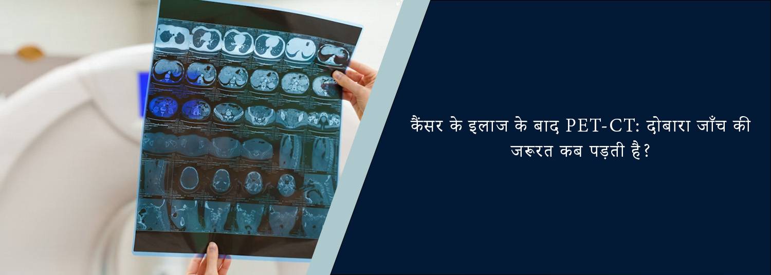 कैंसर के इलाज के बाद PET-CT: दोबारा जाँच की जरूरत कब पड़ती है?