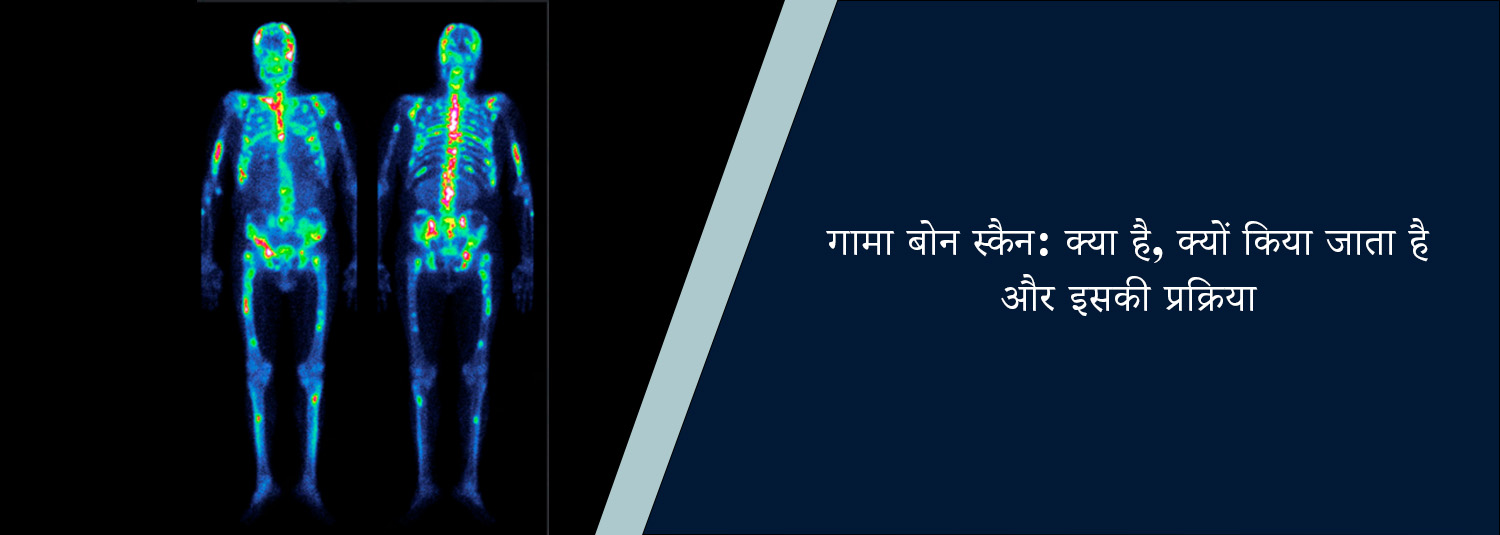 गामाबोन स्कैन: क्या है, क्यों किया जाता है और इसकी प्रक्रिया