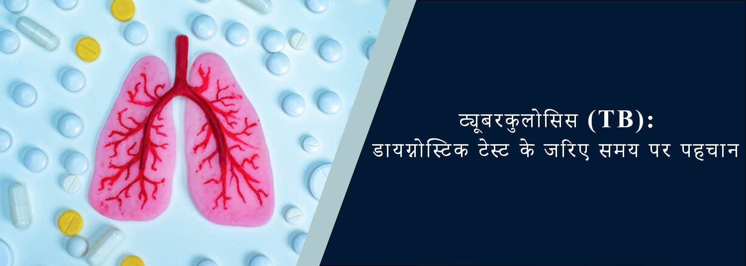 ट्यूबरकुलोसिस (TB): डायग्नोस्टिक टेस्ट के जरिए समय पर पहचान