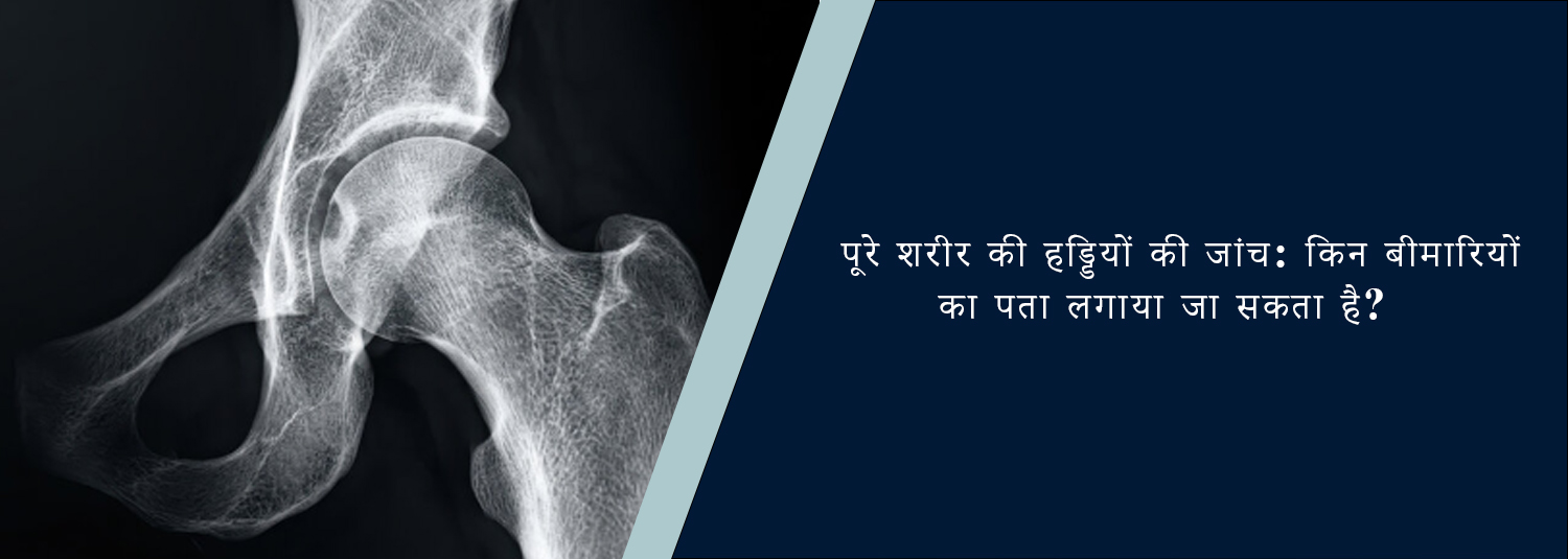 पूरे शरीर की हड्डियों की जांच: किन बीमारियों का पता लगाया जा सकता है?