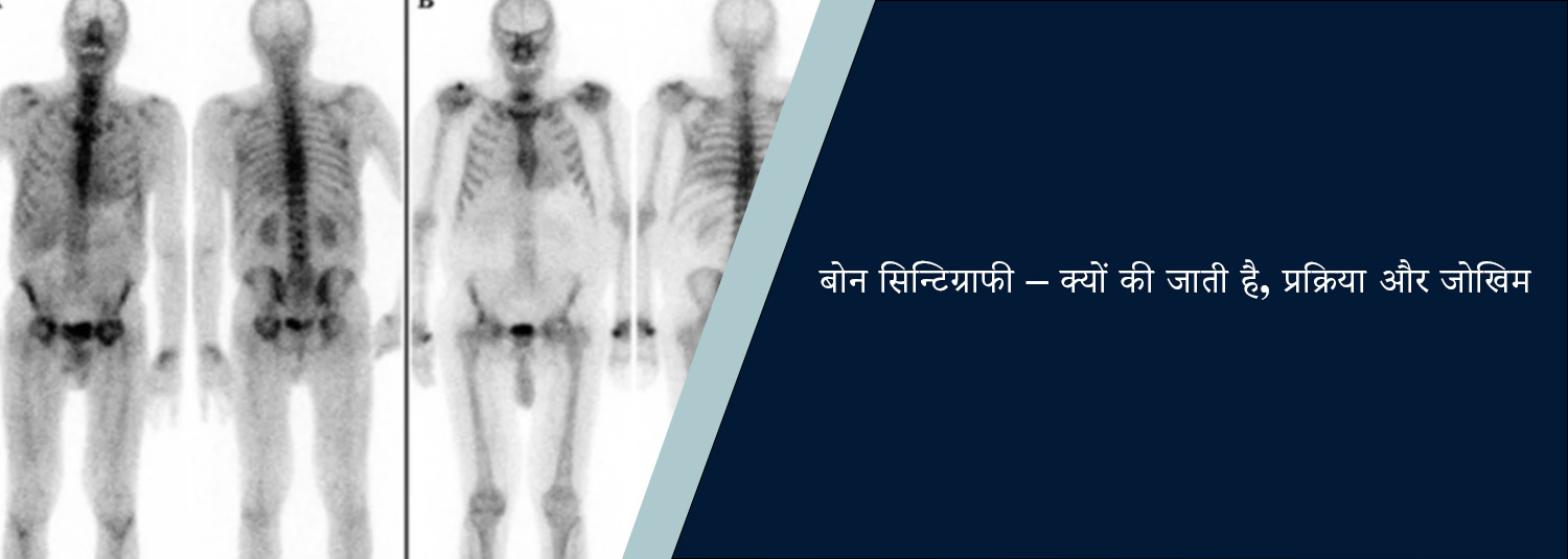 बोन सिन्टिग्राफी – क्यों की जाती है, प्रक्रिया और जोखिम