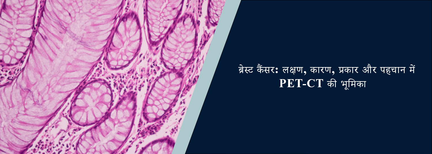 ब्रेस्ट कैंसर: लक्षण, कारण, प्रकार और पहचान में PET-CT की भूमिका