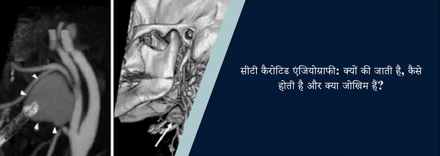 सीटी कैरोटिड एंजियोग्राफी: क्यों की जाती है, कैसे होती है और क्या जोखिम हैं?