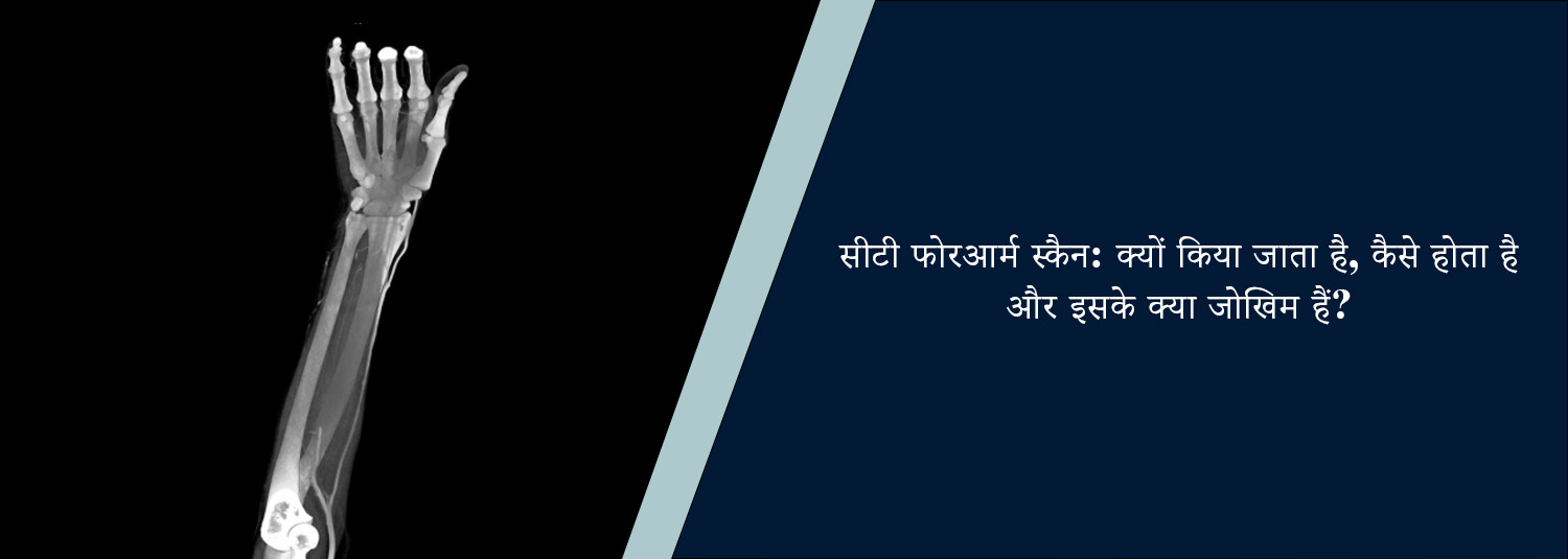 सीटी फोरआर्म स्कैन: क्यों किया जाता है, कैसे होता है और इसके क्या जोखिम हैं?