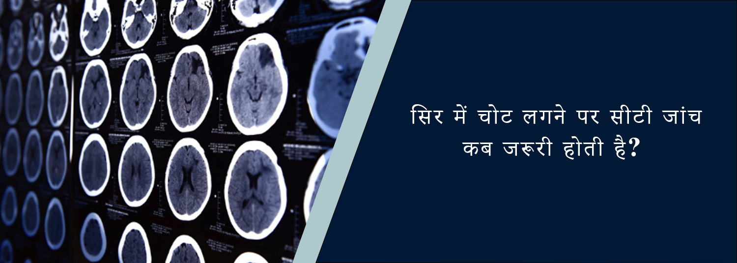 सिर में चोट लगने पर सीटी जांच कब जरूरी होती है?