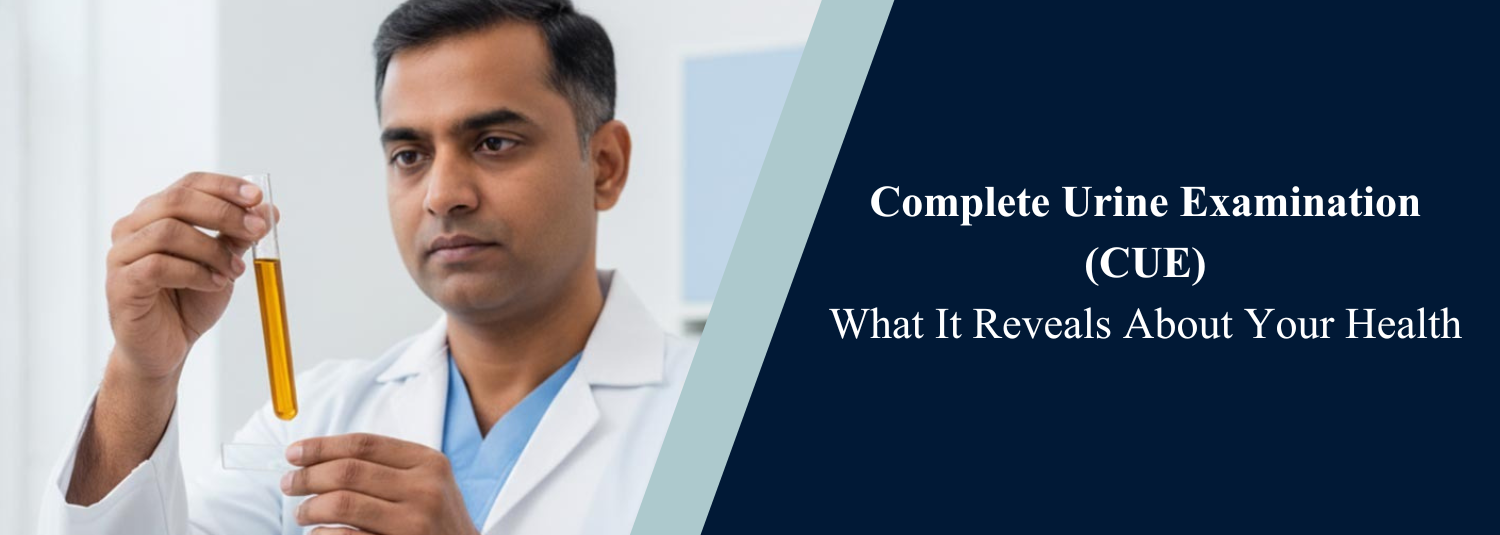 Complete Urine Examination (CUE): What It Reveals About Your Health