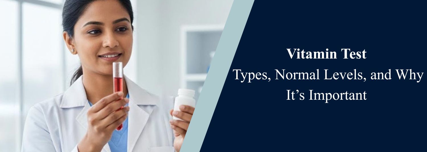 Vitamin Test: Types, Normal Levels, and Why It’s Important