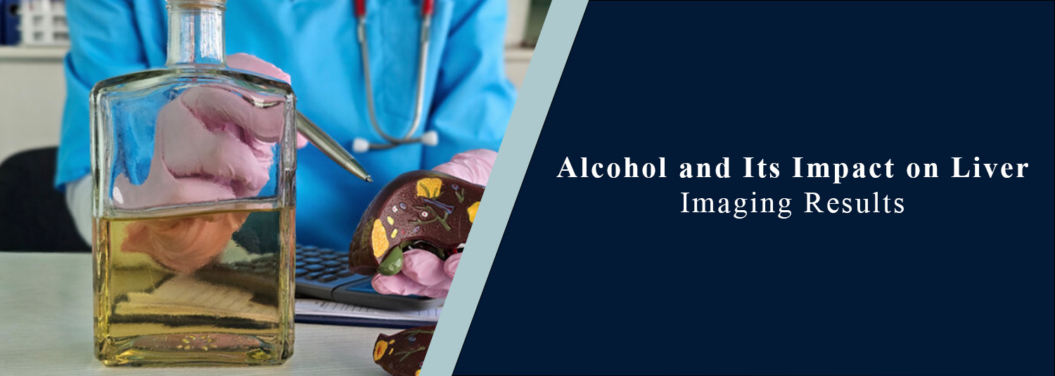 Alcohol and Its Impact on Liver Imaging Results
