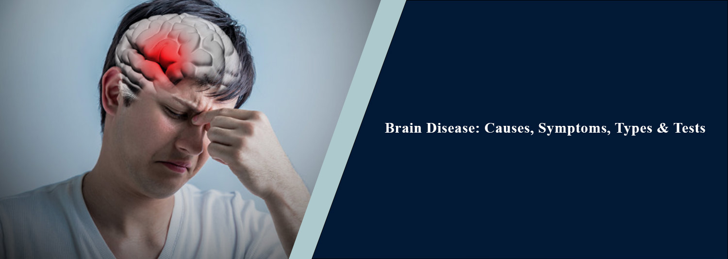 Brain Disease: Causes, Symptoms, Types & Tests