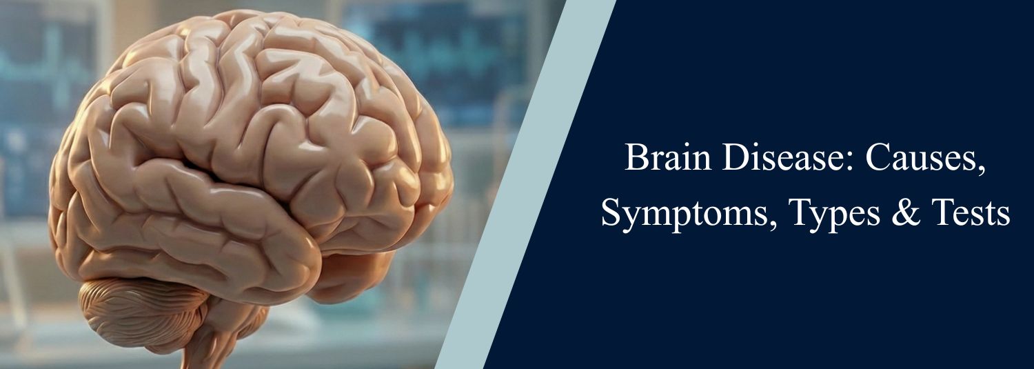 Brain Disease: Causes, Symptoms, Types & Tests