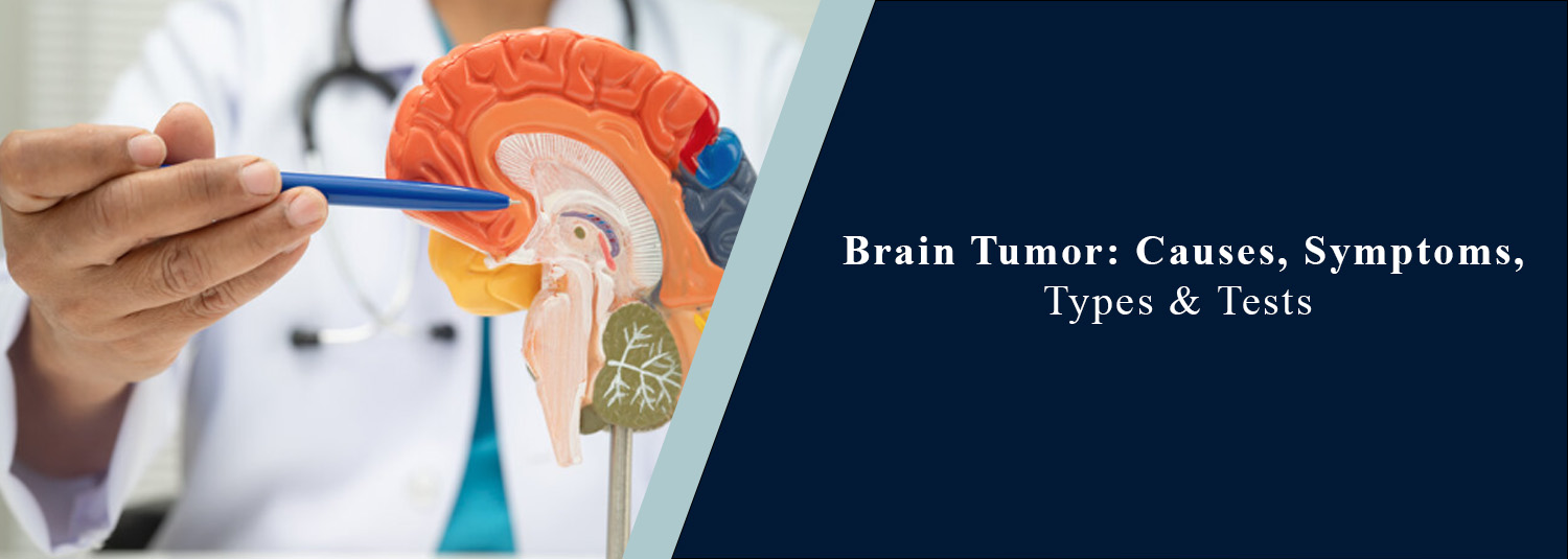 Brain Tumor: Causes, Symptoms, Types & Tests