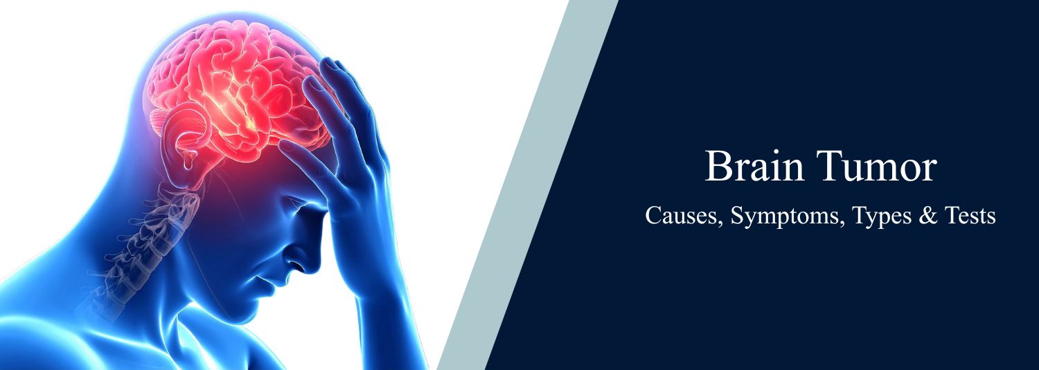 Brain Tumor: Causes, Symptoms, Types & Tests