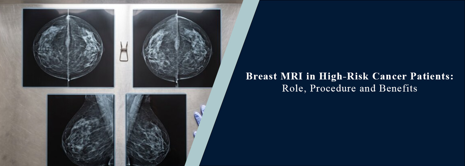 Breast MRI in High-Risk Cancer Patients: Role, Procedure and Benefits