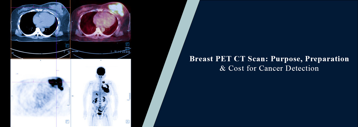 Breast PET-CT Scan: Purpose, Preparation and Cost for Cancer Detection