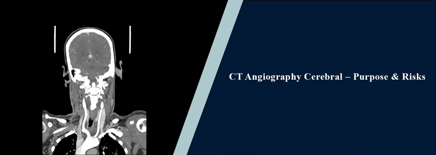 CT Angiography Cerebral – Purpose and Risks
