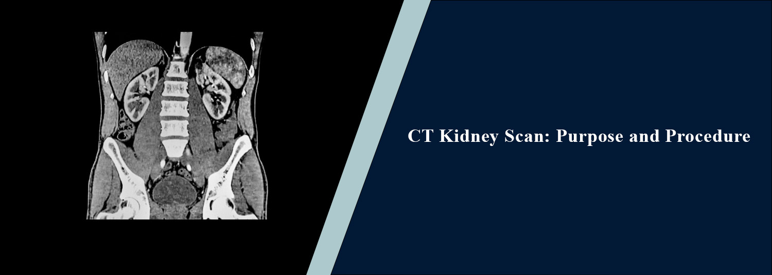CT Kidney Scan: Purpose and Procedure