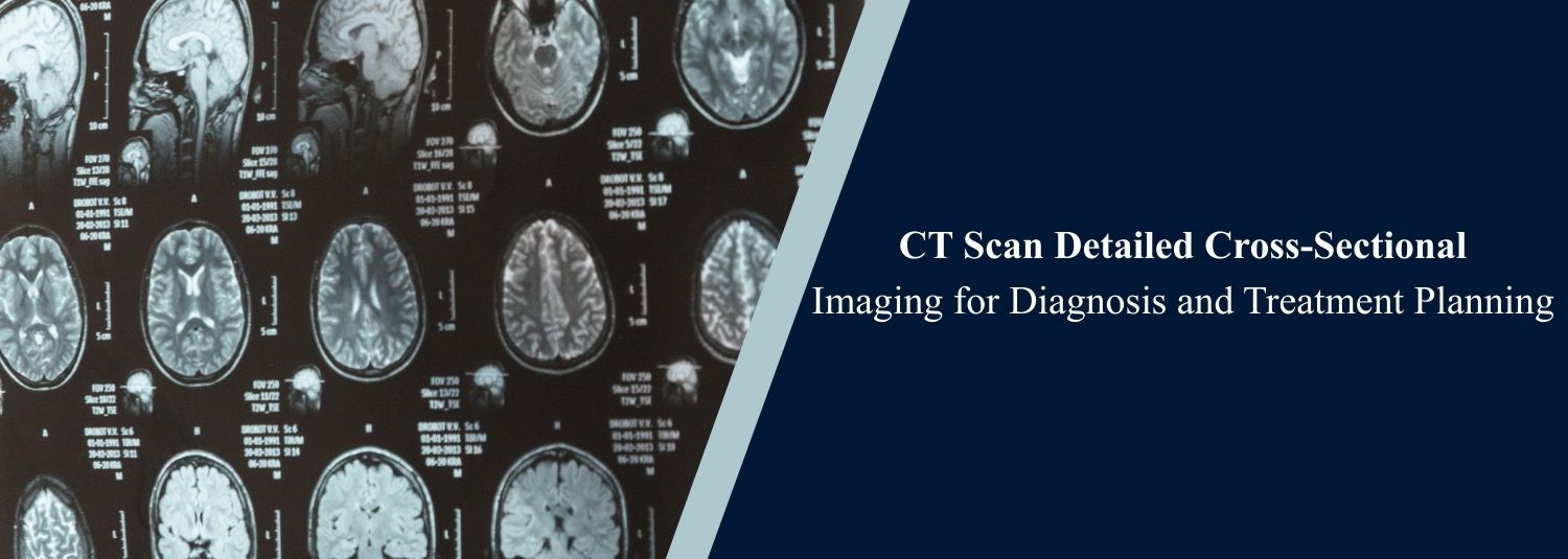 CT Scan: Detailed Cross-Sectional Imaging for Diagnosis and Treatment Planning
