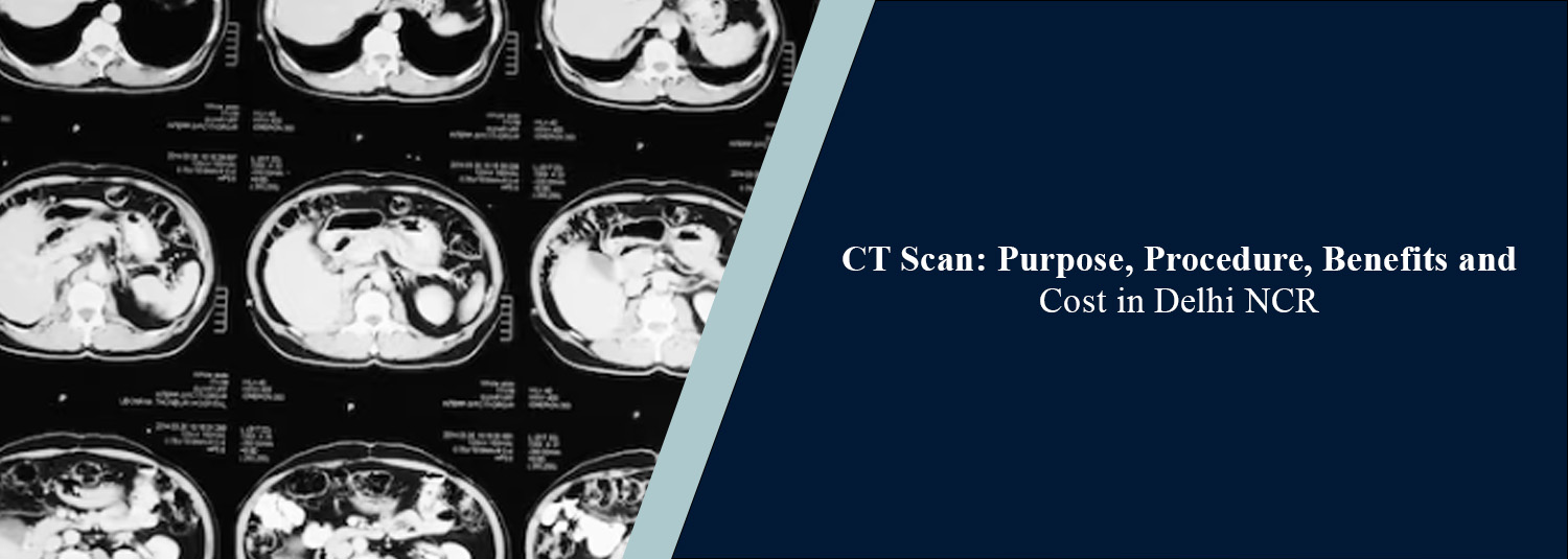 CT Scan: Purpose, Procedure, Benefits and Cost in Delhi NCR