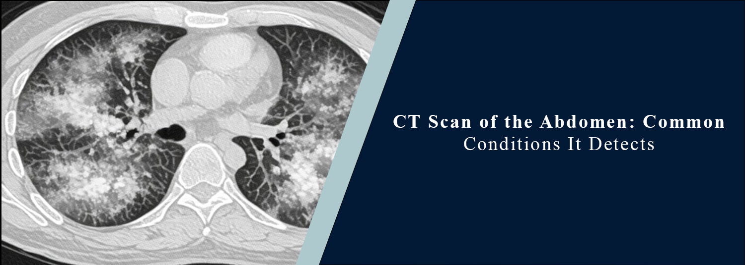 CT Scan of the Abdomen: Common Conditions It Detects