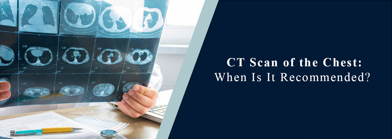 CT Scan of the Chest: When Is It Recommended?