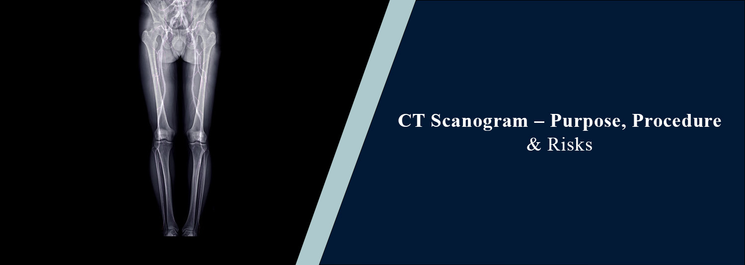 CT Scanogram: Purpose, Procedure, and Risks