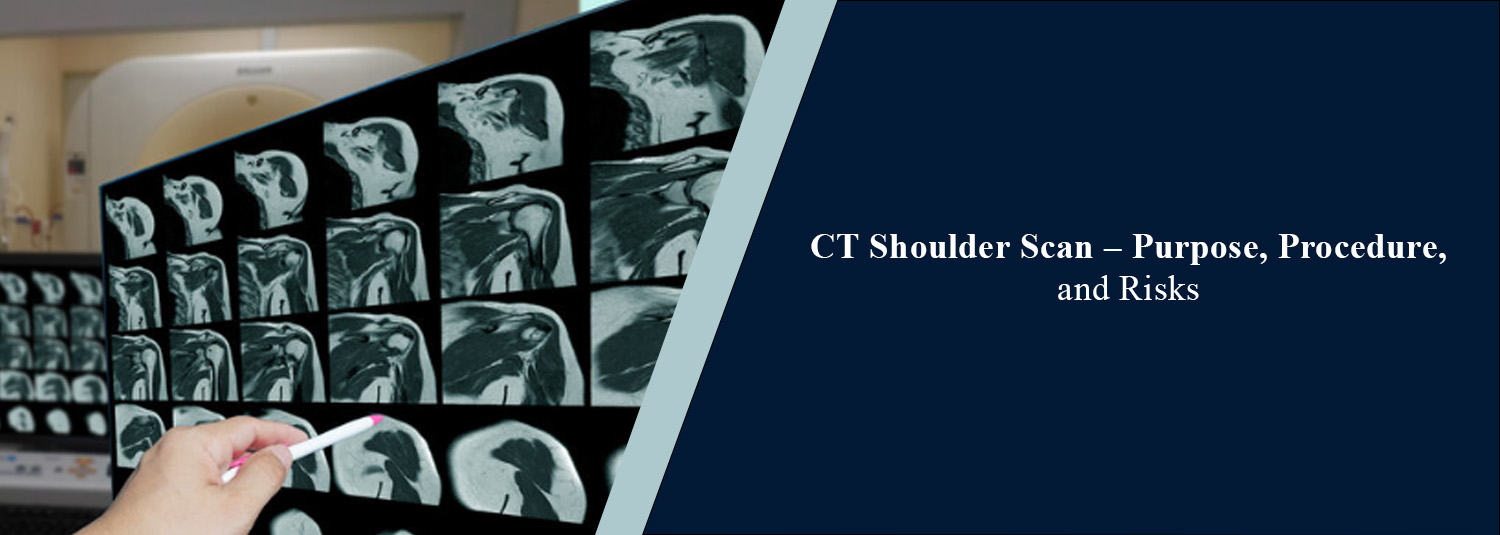 CT Shoulder Scan: Purpose, Procedure, and Risks