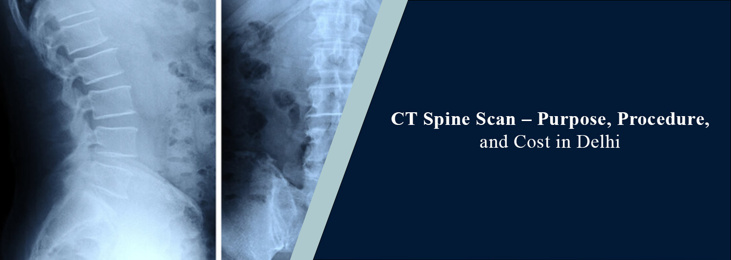 CT Spine Scan: Purpose, Procedure, and Cost in Delhi