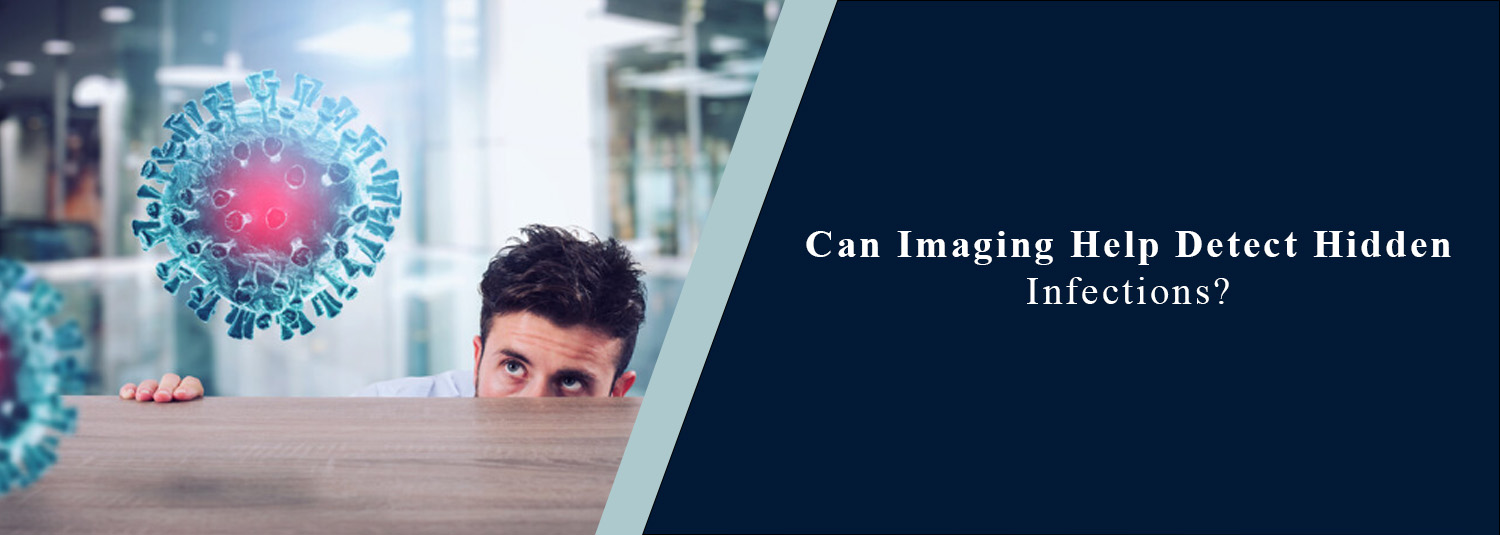 Can Imaging Help Detect Hidden Infections?