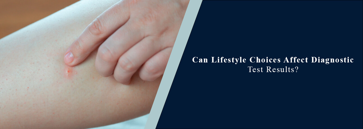 Can Lifestyle Choices Affect Diagnostic Test Results?