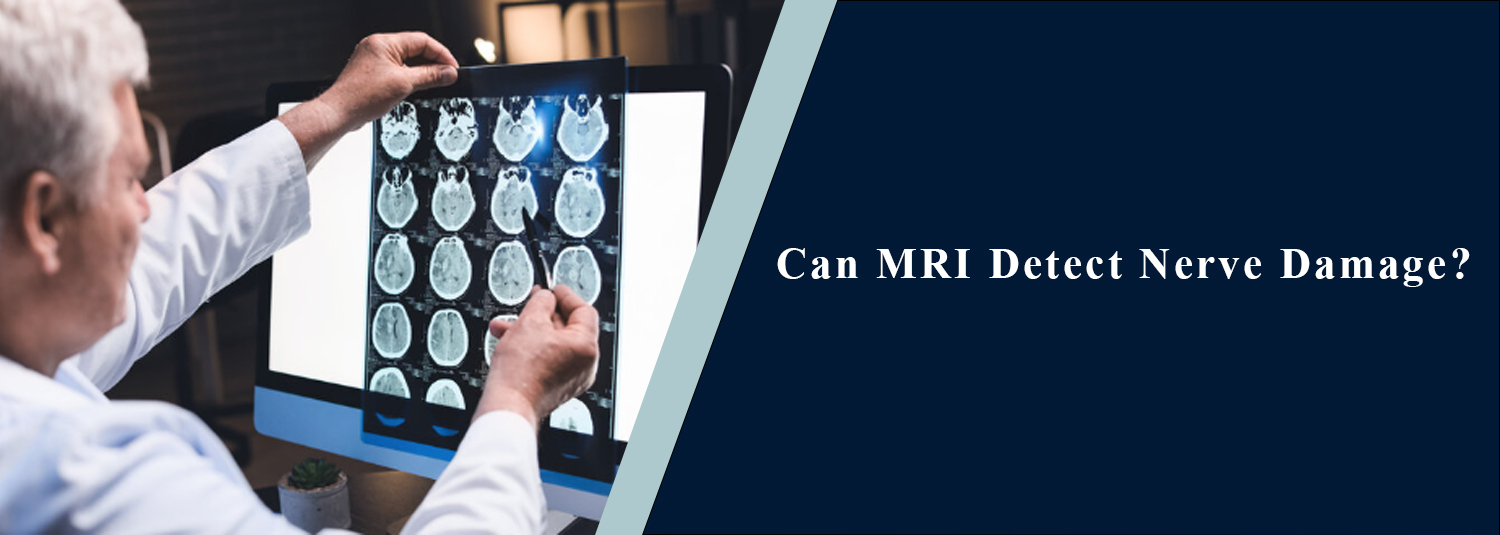 Can MRI Detect Nerve Damage?