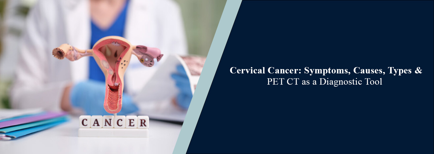 Cervical Cancer: Symptoms, Causes, Types & PET-CT as a Diagnostic Tool