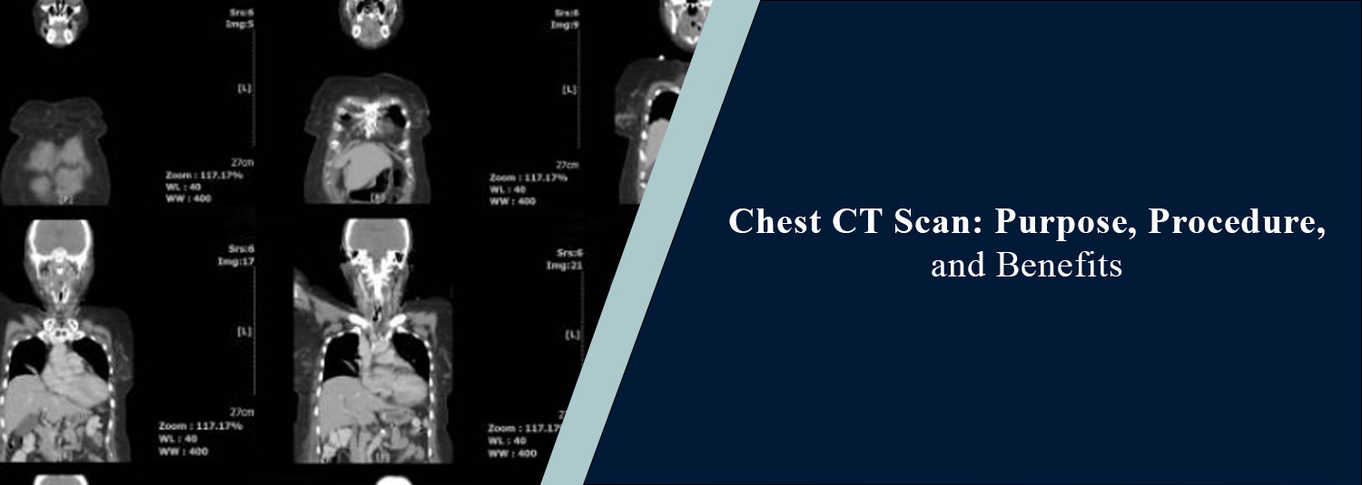 Chest CT Scan: Purpose, Procedure, and Benefits