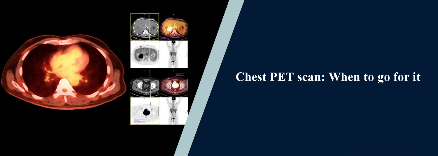 Chest PET Scan: When to Go for It
