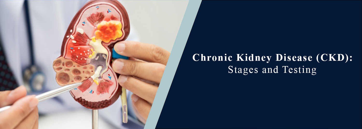Chronic Kidney Disease: Stages and Testing