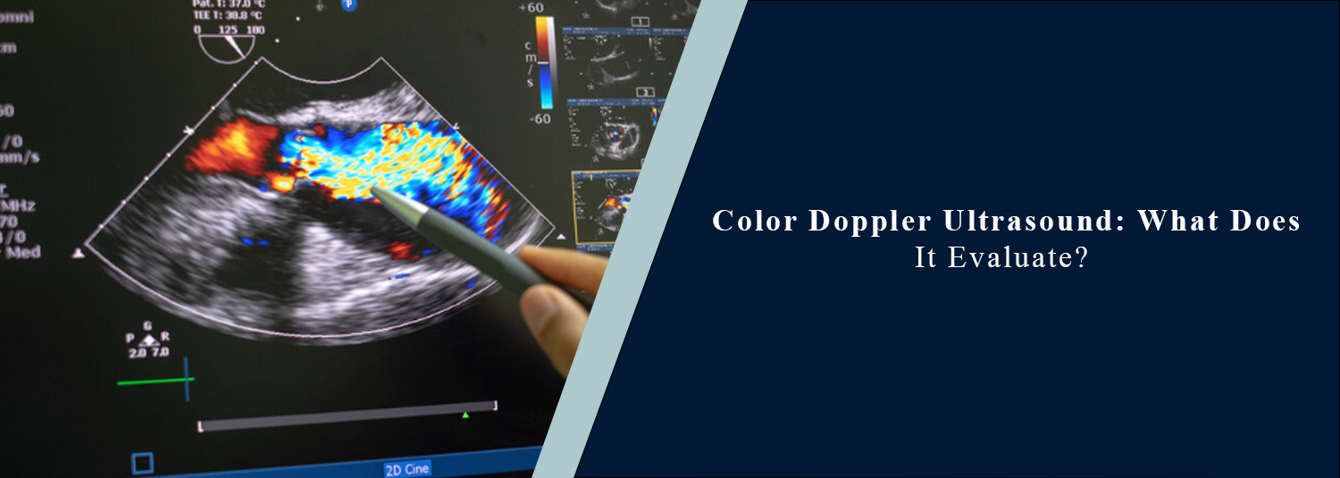 Color Doppler Ultrasound: What Does It Evaluate?