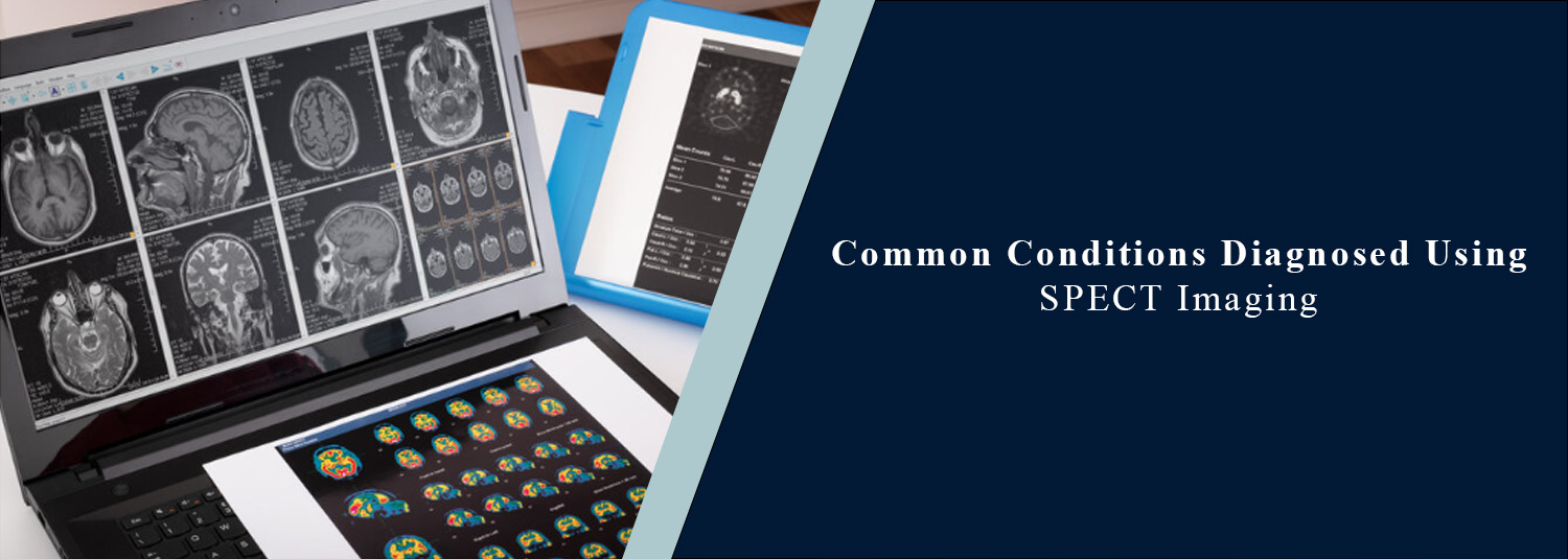 Common Conditions Diagnosed Using SPECT Imaging