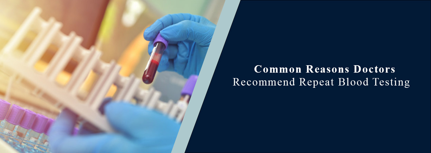 Common Reasons Doctors Recommend Repeat Blood Testing
