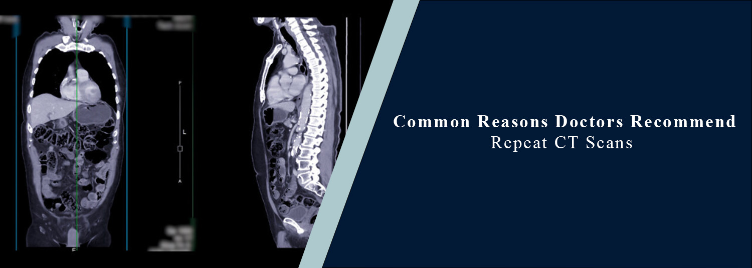 Common Reasons Doctors Recommend Repeat CT Scans