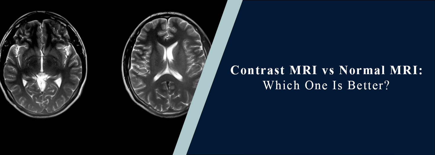 Contrast MRI vs Normal MRI: Which One Is Better?