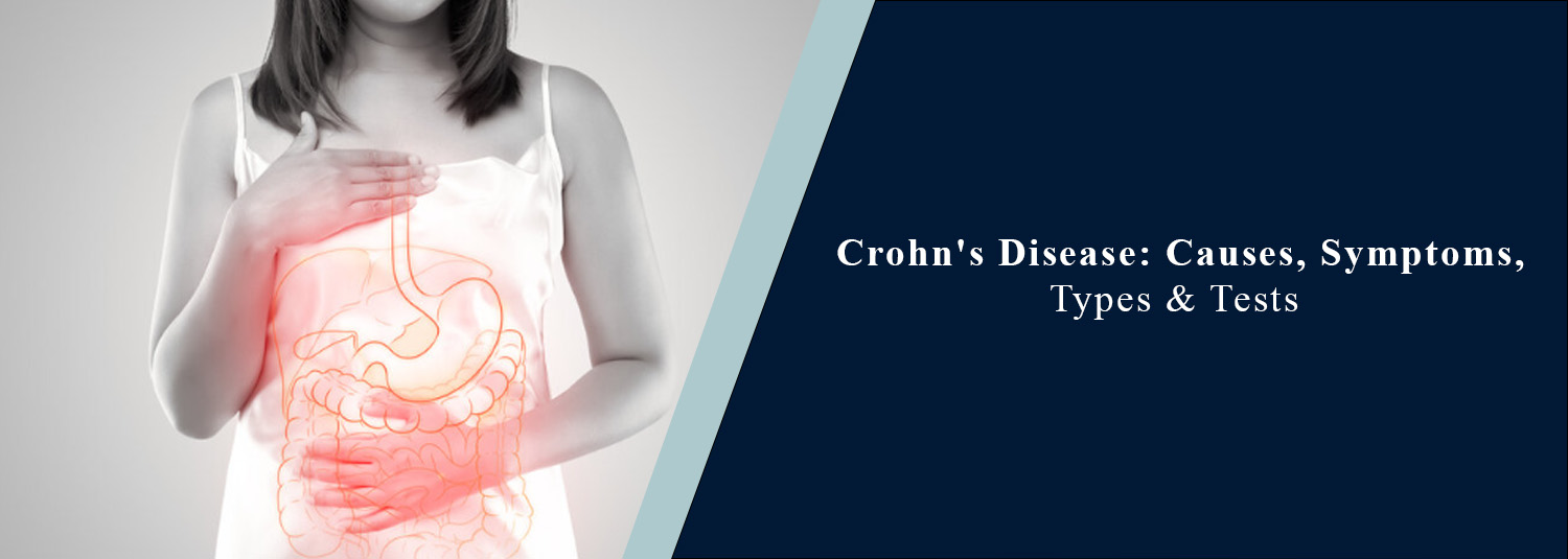 Crohn's Disease: Causes, Symptoms, Types & Tests