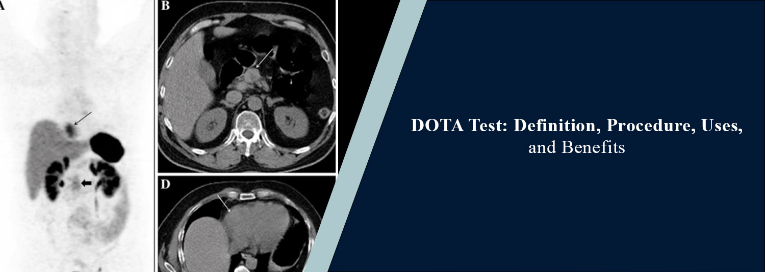 DOTA Test: Definition, Procedure, Uses, and Benefits