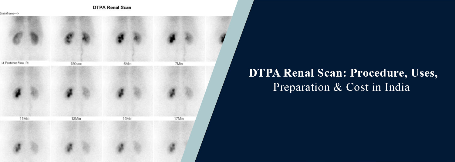 DTPA Renal Scan: Procedure, Uses, Preparation & Cost in India