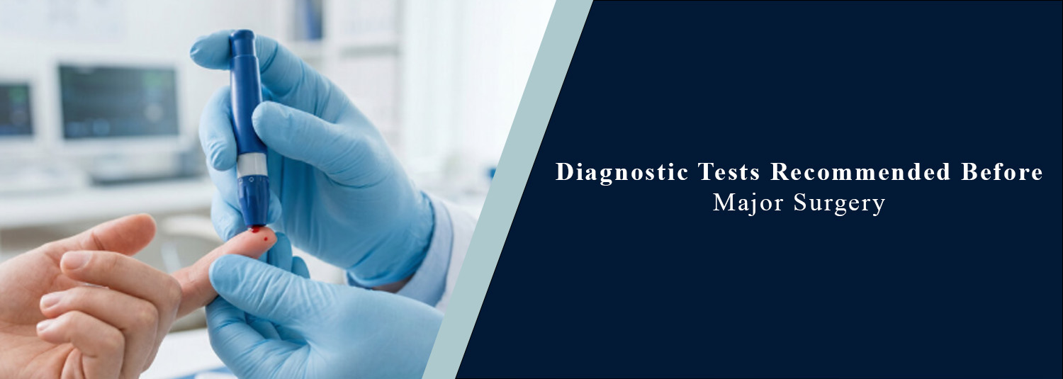 Diagnostic Tests Recommended Before Major Surgery