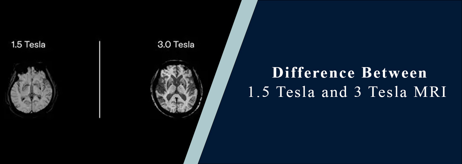Difference Between 1.5 Tesla and 3 Tesla MRI