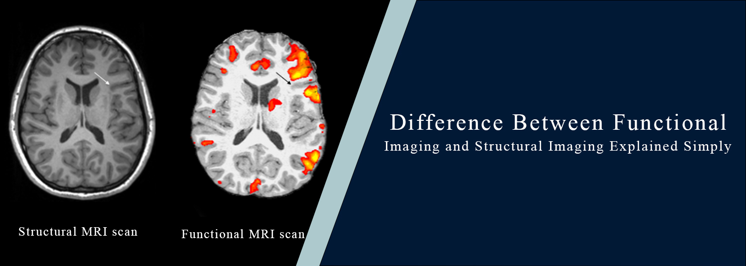 Difference Between Functional Imaging and Structural Imaging Explained Simply
