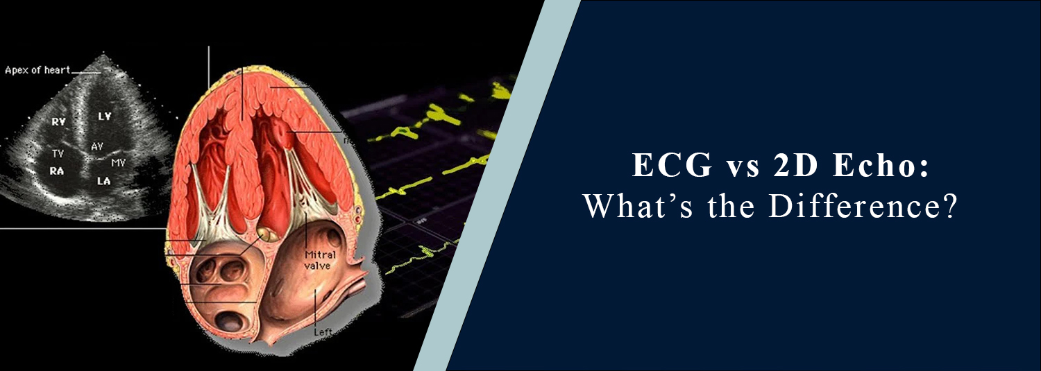 ECG vs 2D Echo: What’s the Difference?