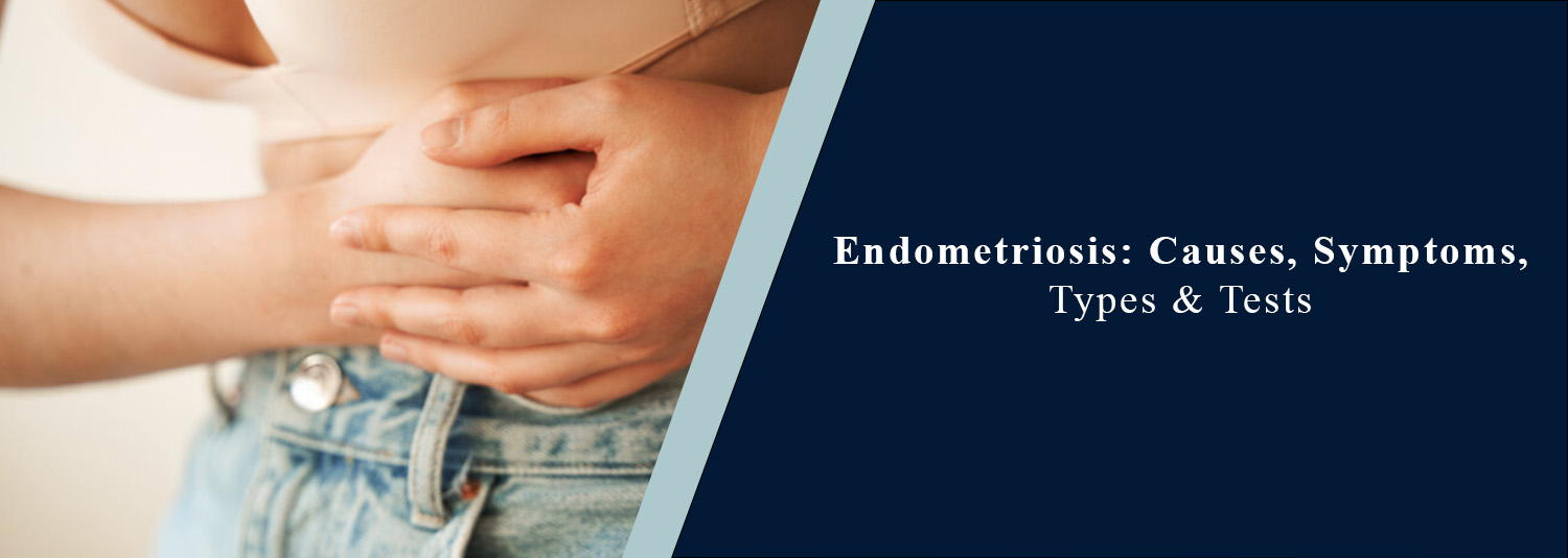 Endometriosis: Causes, Symptoms, Types & Tests